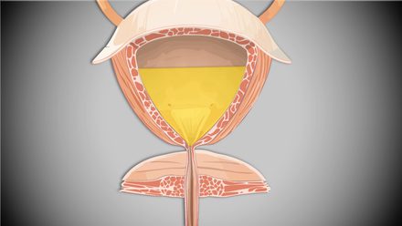 urinary continence management care course